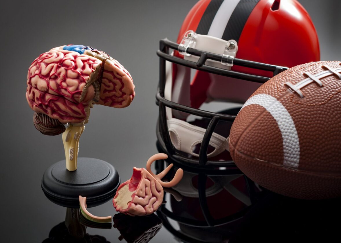 How Head Trauma can affect the brain signs of CTE
